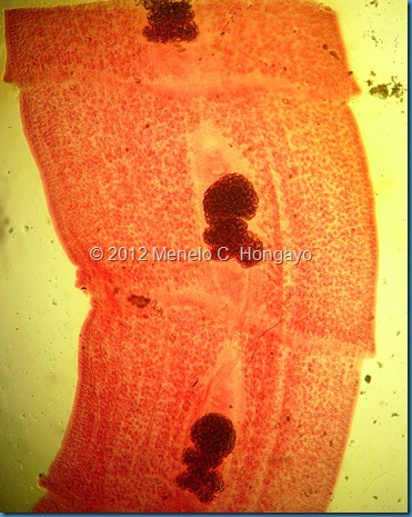 2 Diphyllobothrium latum (mature proglottid) (2)