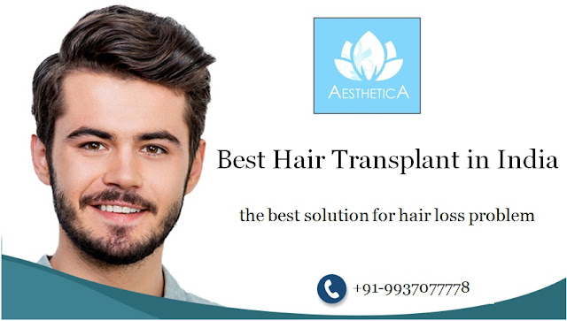 Best Hair Transplant Surgeons in India