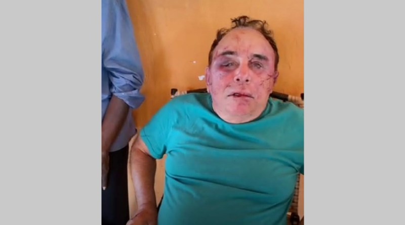 Vídeo! Candidato a prefeito de Santa Terezinha Arimateia é brutalmente agredido por bandidos na manhã deste domingo (08). Família é feita refém