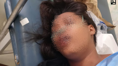 Hieren de bala joven en «tiroteo» anoche en La Guázara