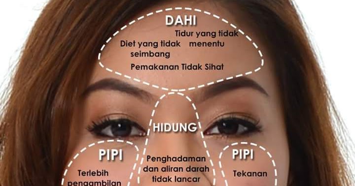 Cara Nak Hilangkan Jerawat Dengan Ubat Gigi - Omong a