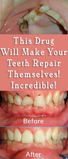 This Drug Will Make Your Teeth Repair Themselves! Incredible!