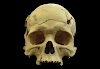 Skull shows man survived surgery to ease brain pressure 2700 years ago