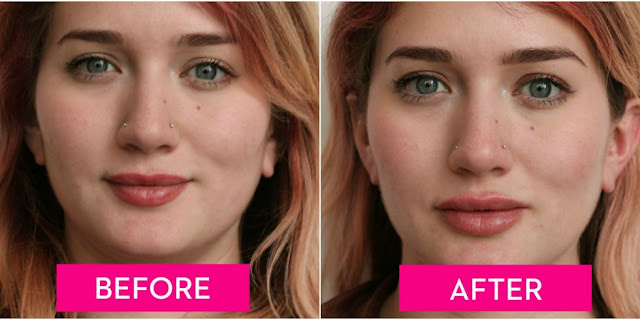 How To Get Fuller Lips Without Injections