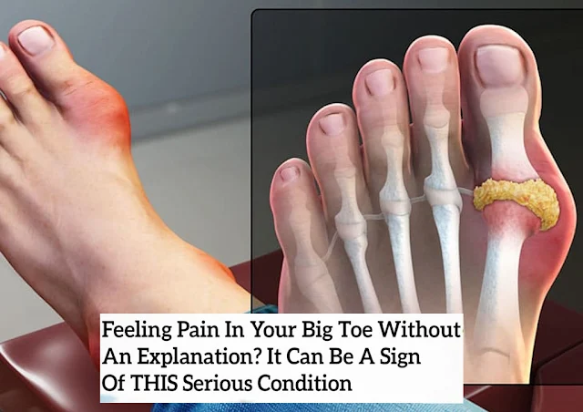 Feeling Pain In Your Big Toe Without An Explanation? It Can Be A Sign Of THIS Serious Condition