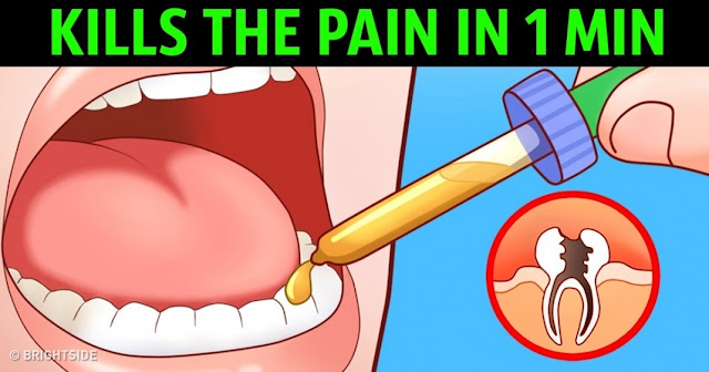  Best Toothache Relief Remedy Product In The World - How To get Rid Of A Toothache 