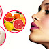 Tips to Get Rosy Cheeks Naturally