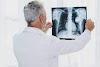 Guía práctica: Cómo interpretar radiografías de tórax como un profesional y evitar confusiones