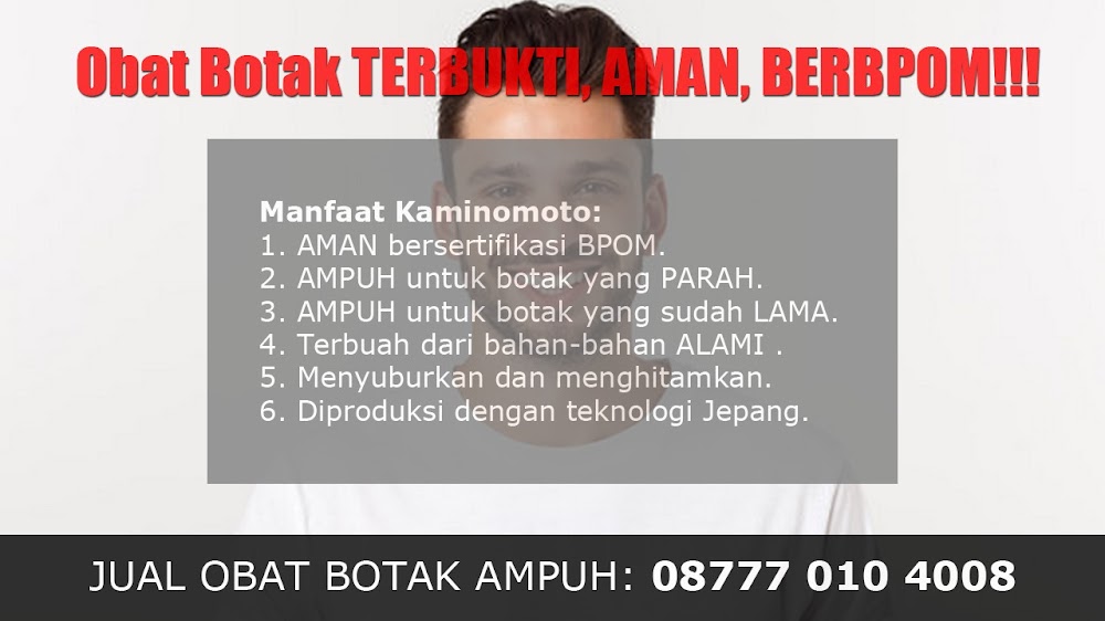 CARA PENUMBUH RAMBUT DENGAN CEPAT<br/>Menanggal<br/>