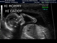 BABY_24