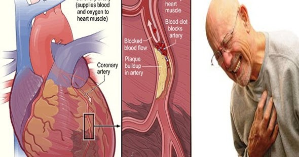 KEMBARA ALAM AADK: Kenali sakit jantung - Tips Penjagaan 