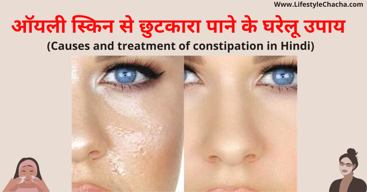 Home remedies to get rid of oily skin in Hindi