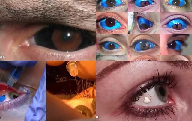 10 Very Bizarre Trends From Around The World 2. Eye tattoos and jewelry