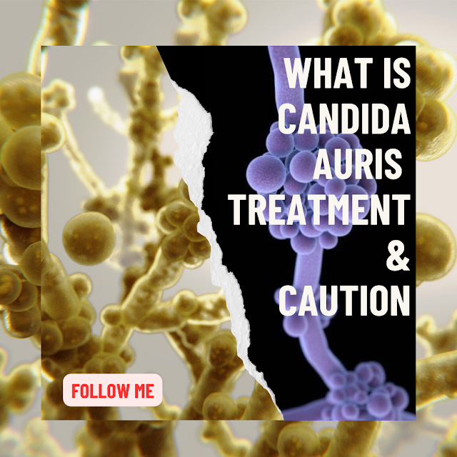 Candida Auris-what is candida auris-treatment-caution