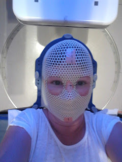 This is me wearing my radiation mask during the first of 5 radiation treatments to my left eye