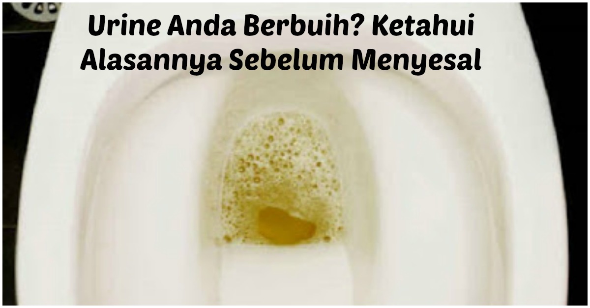 Saat Buang Air Kecil Urine Kamu Berbuih Banyak? Ketahui Alasannya Sebelum Menyesal !!