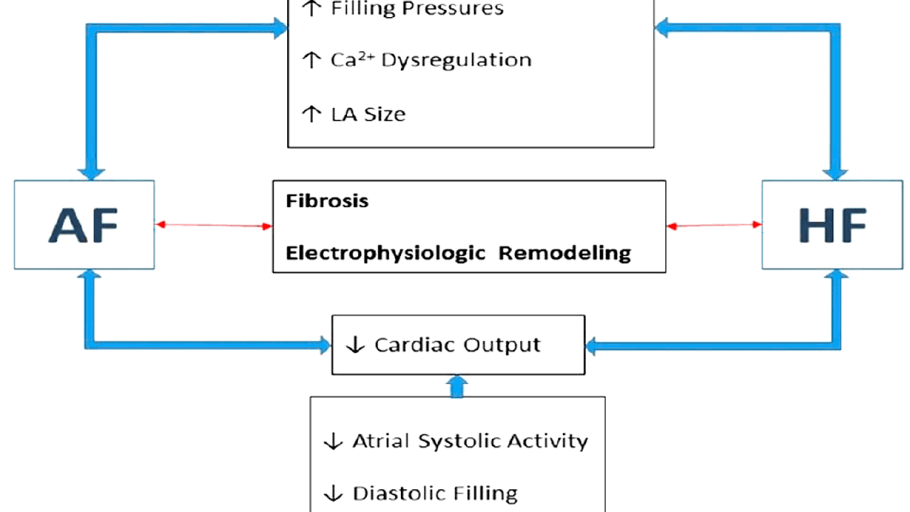 Atrial Fibrillation And Heart Failure