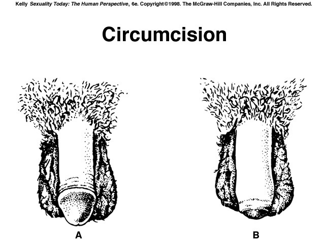 UNCIRCUMCISED PENIS' I WAS CURIOUS CHIMP ATTACK VICTIMS