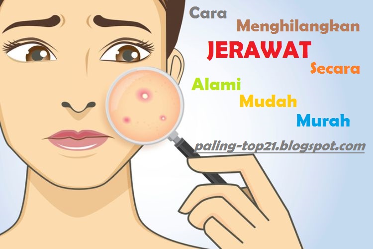 Cara atasi jerawat