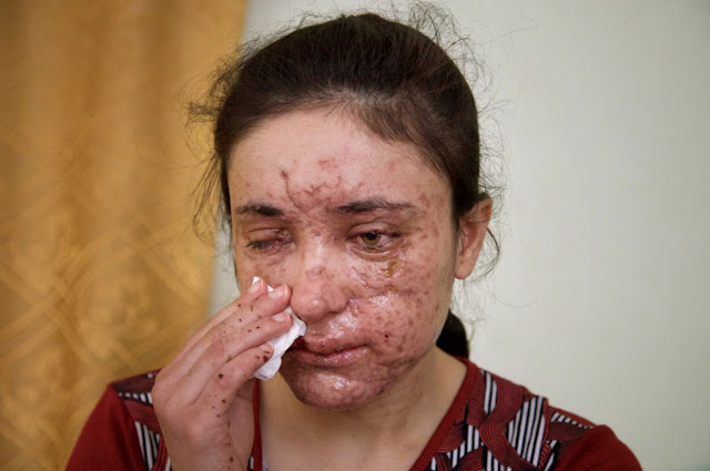 Lamiya Aji Bashar, an 18-year-old Yazidi girl who escaped her Islamic State group enslavers.