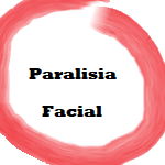 paralisia facial