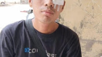 PT. Agro Sarimas Indonesia Tidak Sediakan Alat Perlindungan Diri, Pekerja Alamai Cacat Mata Seumur Hidup