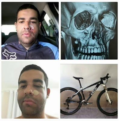 Ciclista atacado a paulada no Rio Vermelho neste domingo relata agressão nas redes sociais