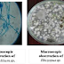 Praktikum Mikologi : Pengenalan Mikroskopik Jamur