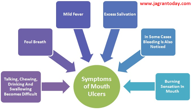 Mouth Oral Ulcer