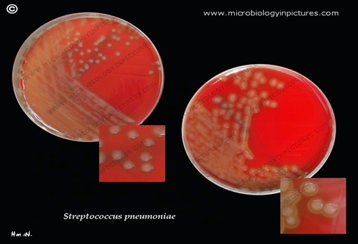 Dos cepas de Streptococcus pneumonie. A la izquierda las colonias virulentas lisas con respecto al agar y a la derecha las cepas no virulentas rodeadas por un halo de alfa-hemólisis, agar Columbia con 5% de sangre de cordero defibrinada y al 5% de dióxido de carbono