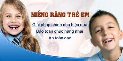 Có nên niềng răng trẻ em?