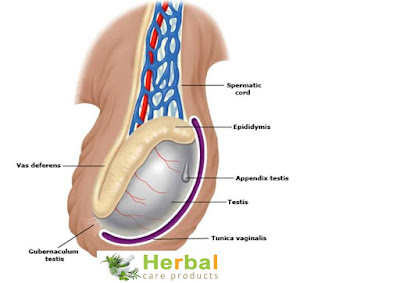 What is Hydrocele