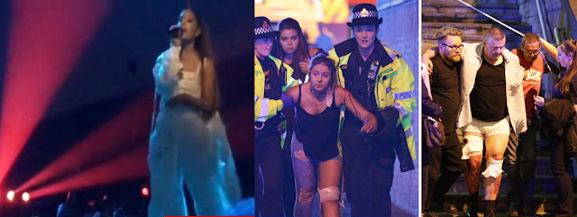 Picture of Ariana Grande before explosion and Injured Fans after the Explosion