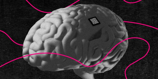 Brain Implant Offers Hope For Treatment‑Resistant Depression