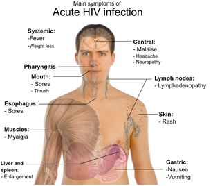 PUSAT PERUBATAN HOLISTIK DAN ALTERNATIF: CIRI PENGIDAP HIV