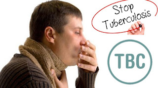Inilah Gejala Dan Penyebab Dari Penyakit Tbc