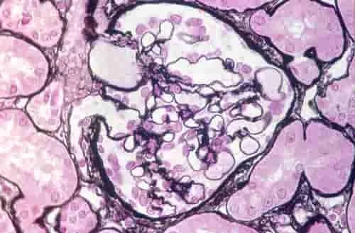 Células renais humanas Histologia humana: glomérulo renal.