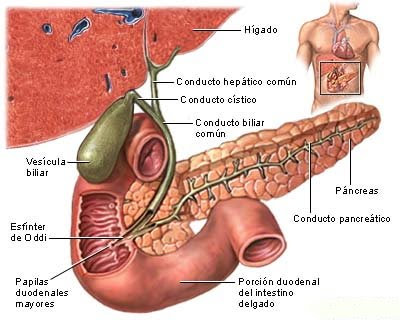 piedras en la vesicula. Salud: ¿Qué es la colelitiasis