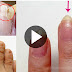 The Fastest Wat To Repair Half And Full Broken Nail Very Fast