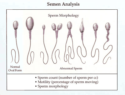 What does a healthy sperm look like I love the above illustration