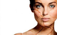 Cara alami mengatasi kulit wajah yang kering | widadaraharja.blogspot.com