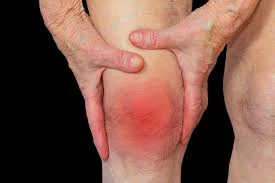 Arthritis: Symptoms, Causes, Risk Factors, Complications, Treatment