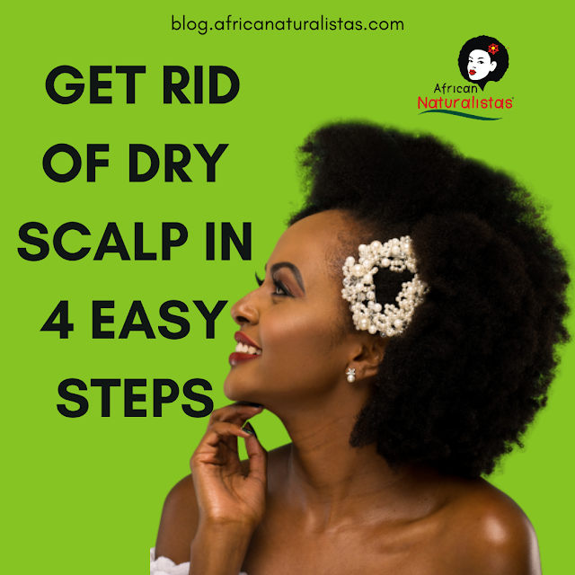 GET RID OF DRY SCALP IN 4 EASY STEPS