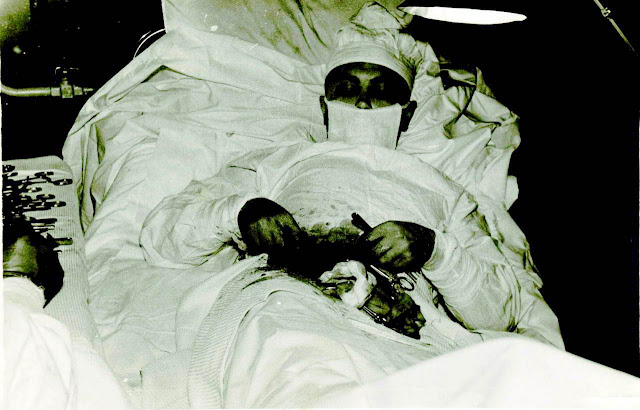 april 30, 1961 leonid rogozov operated himself from appendicitis during antarctic expedition