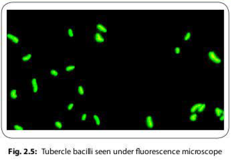 Tubercle bacilli seen under fluorescence microscope