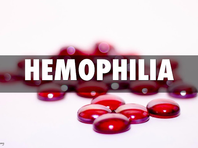 Hemophilia Treatment Market