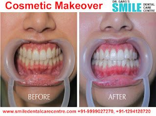 Cosmetic Makeover Faridabad