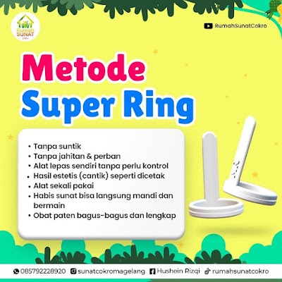 Metode Super Ring