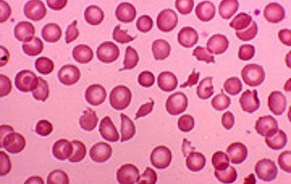 Trombosit DarahPSYCHOLOGYMANIA