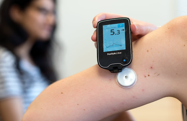 Continuous Glucose Monitoring (CGM) Devices